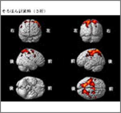 簡単なそろばんでも高度な知能の脳システムが活性化